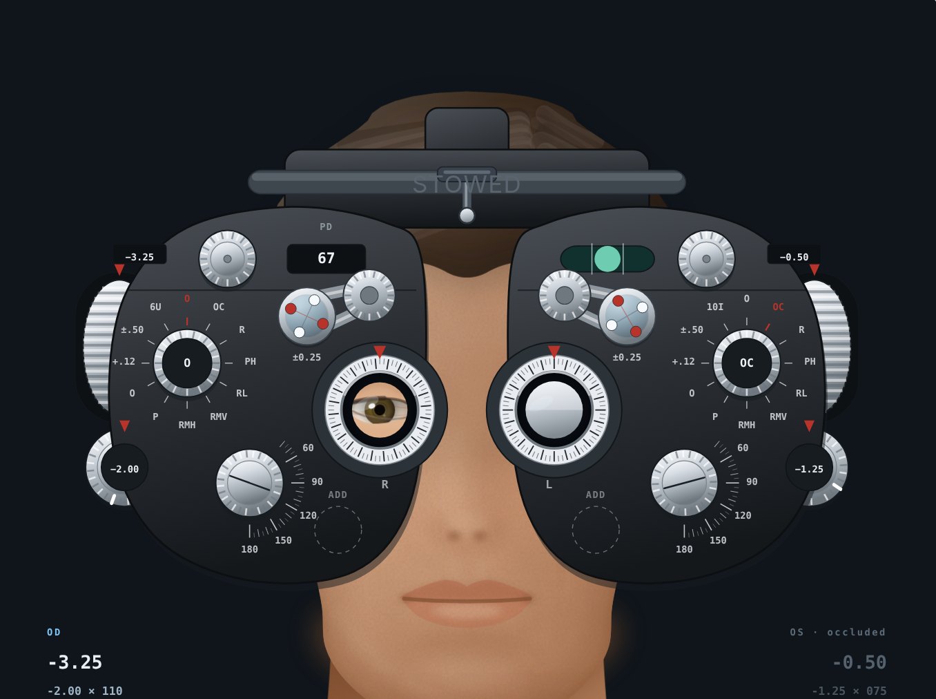 The refraction simulator mid-refraction: a phoropter in front of a patient, the left eye occluded, the cross-cylinder swung in front of the right eye, with sphere, cylinder and axis readouts for each eye.