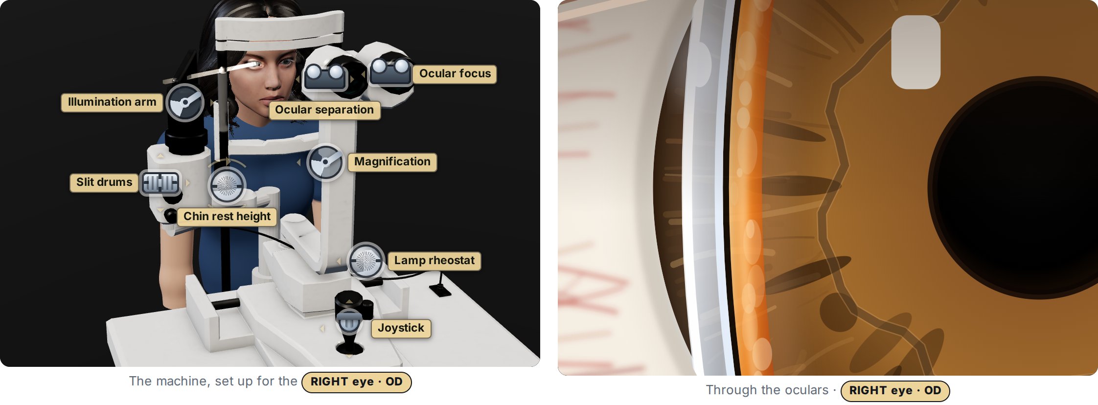 The angle checking simulator at the slit lamp: a 3D slit lamp in front of a seated patient, with labeled controls for the joystick, illumination arm, slit drums, magnification and oculars, beside the view through the oculars showing a thin slit section at the limbus.